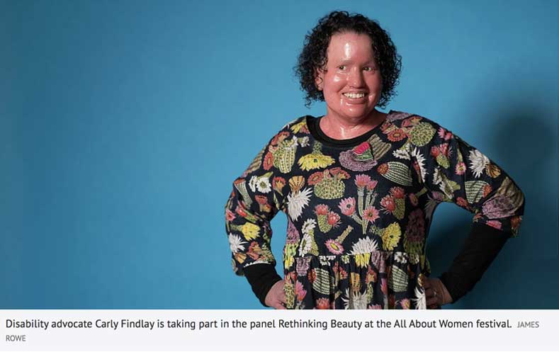 Carly Findlay, performer. Profile by Lenny Ann Low